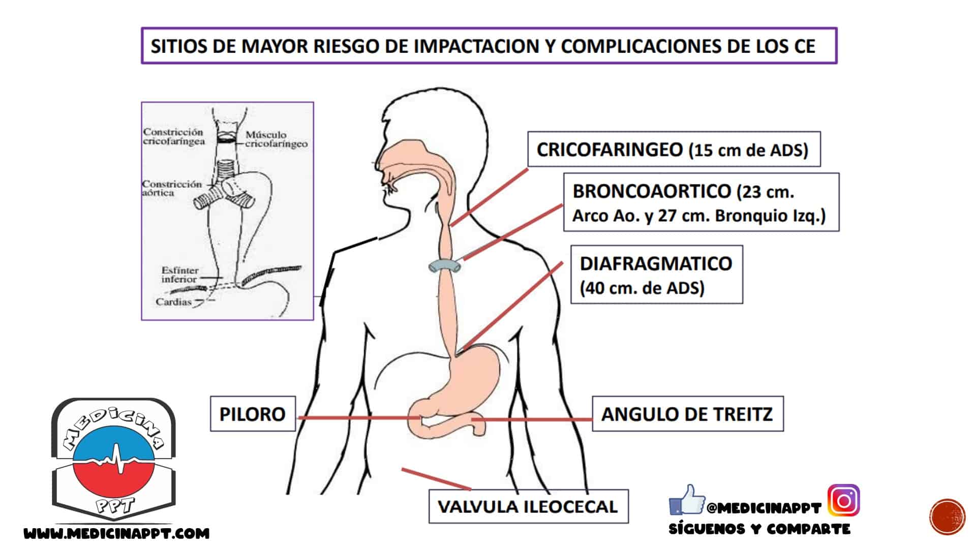 Ingestión pediátrica de pilas de botón: puntuación de riesgo para predecir  resultados graves - SEPEAP